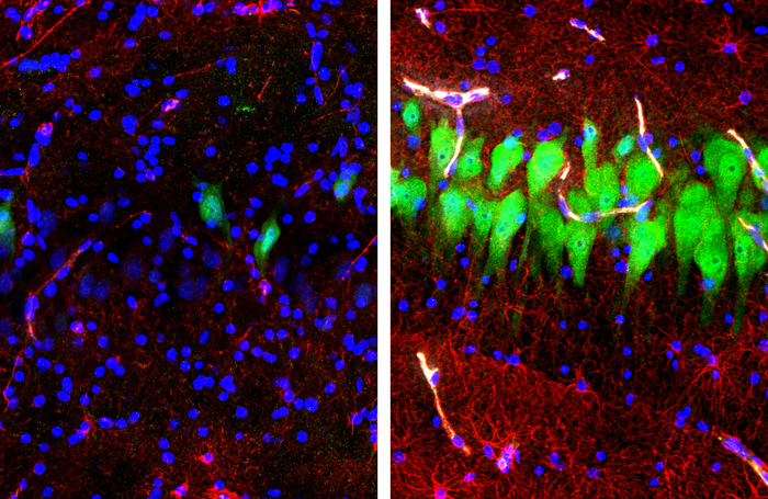 მარჯვენა ფოტოზე BrainEx-ის მიერ შენარჩუნებული უჯრედებია, 10 საათის შემდეგ. მარცხენა ფოტოზე კი საკონტროლო უჯრედები, რომელთა შენარჩუნებაც არ მომხდარა. ნეირონები ფოტოზე მწვანედაა შეღებილი.