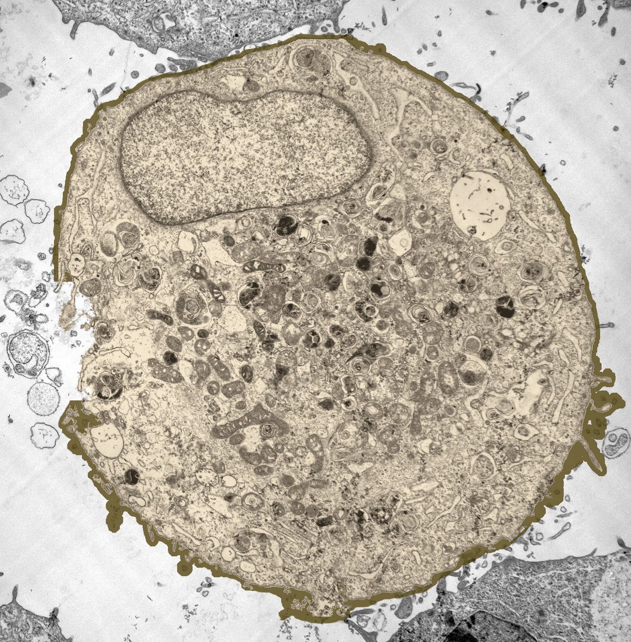 ეუკარიოტული უჯრედის განივკვეთი. ფოტოზე შეგიძლიათ დაინახოთ ბირთვი, მიტოქონდრიები და სხვა ორგანელები