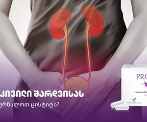 წვა და ტკივილი შარდვისას — როგორ ვუმკურნალოთ ცისტიტს?